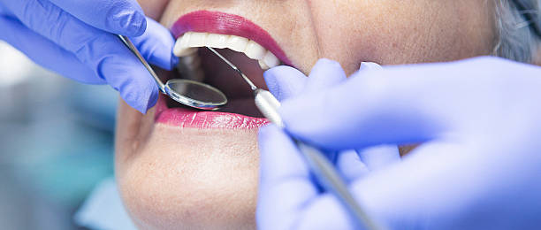 Best Emergency Dental Extractions in Gainesville, TX